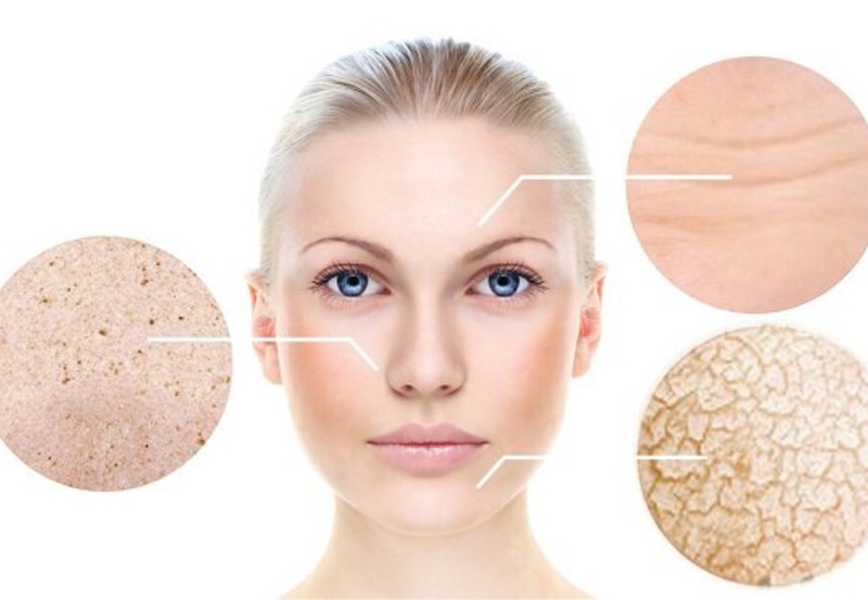 Phân loại các loại da và các phương pháp chăm sóc phù hợp